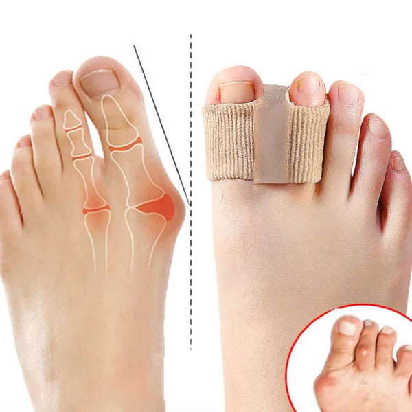 Comfort Toe Aligners